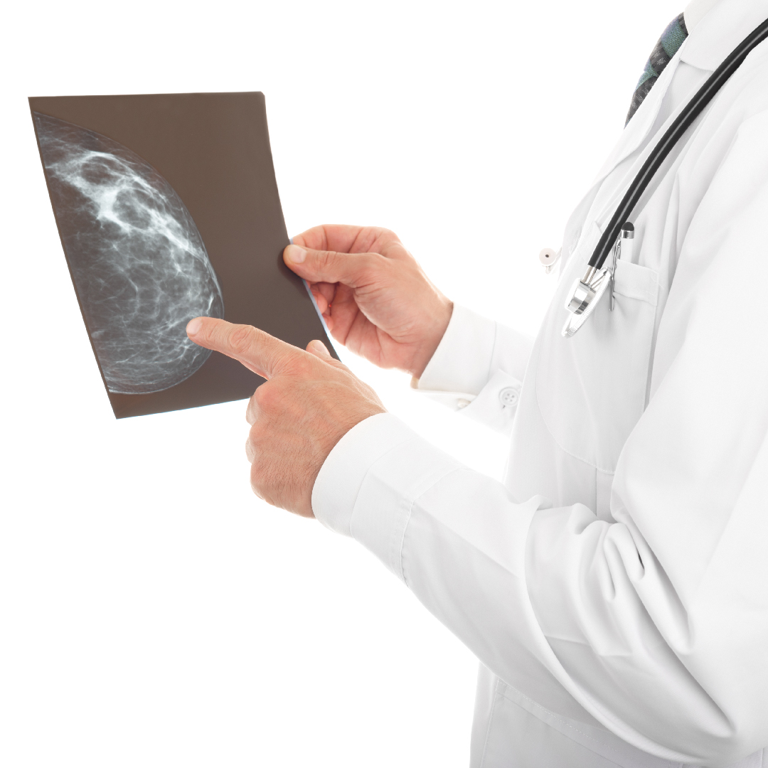 Exames de mamografia no combate ao câncer de mama.